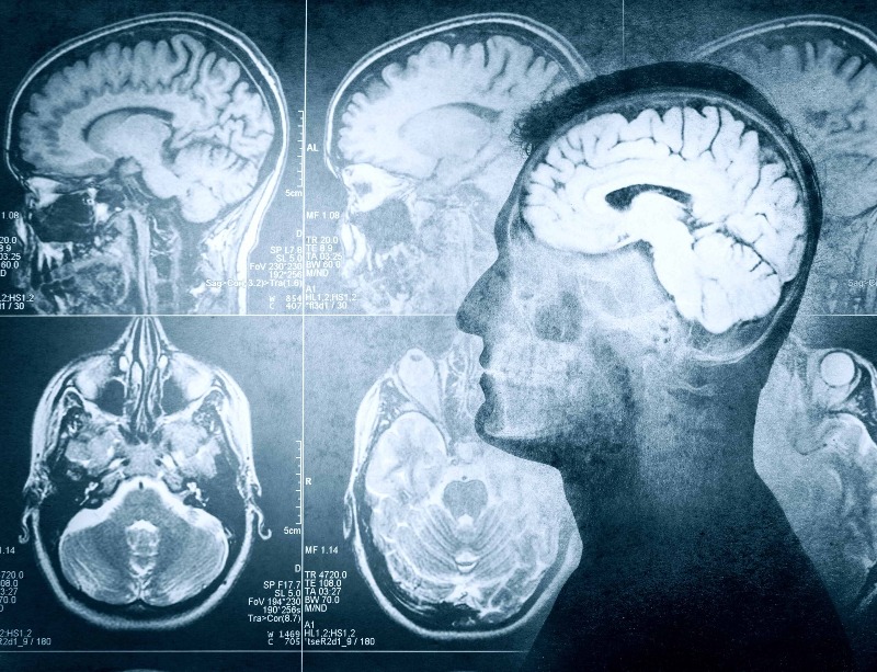 X-rays of human skull and brain